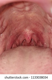 Close Up Inside Of Human Mouth