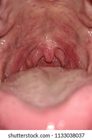 Close Up Inside Of Human Mouth