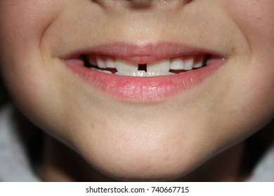 Close Up Of Kids Teeth