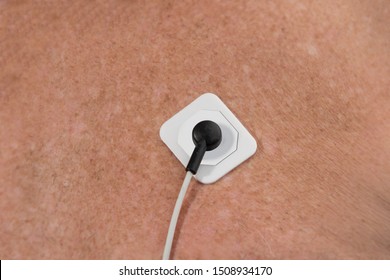 Close Up Of A Lead Attached To An Electrocardiography ECG EKG Electrode On A Male Chest