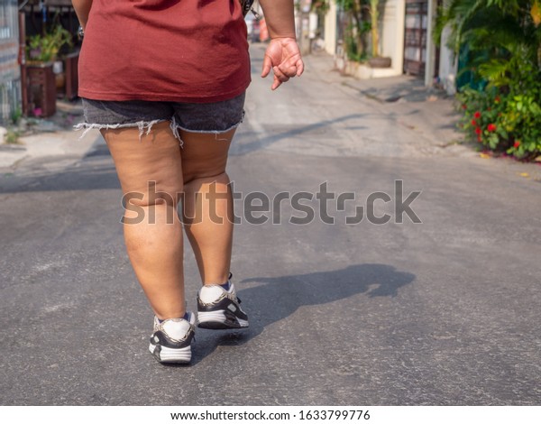 shoes for fat women