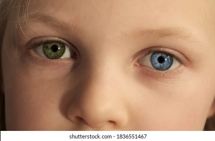 Close Up Of Little Kid Eyes Of Different Colors. Child With Complete Heterochromia. Blue And Green Eyes. Look At Camera.