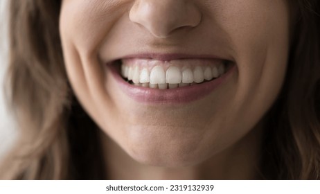 Close up of lower face part and toothy smile of woman. Young female patient of dental clinic, feels satisfied with professional stomatology services, enamel cleaning, whitening, dentalcare and repair - Powered by Shutterstock