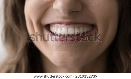 Close up of lower face part and toothy smile of woman. Young female patient of dental clinic, feels satisfied with professional stomatology services, enamel cleaning, whitening, dentalcare and repair