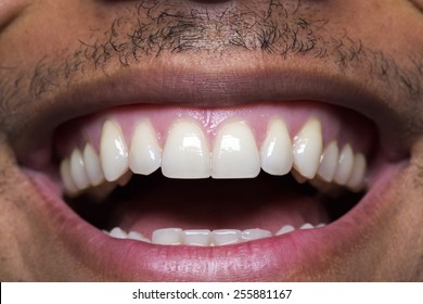 Close Up Macro Shot Of A Male Mouth Laughing And Showing His Straight Teeth