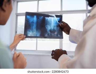 Close up male abdominal x-ray, held by two doctors reviewing medical treatment - Powered by Shutterstock