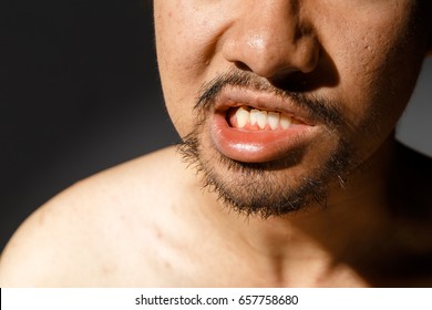 bottom in face Bottom in face