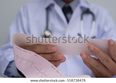 Close up of male cardiologist doctor or medical student in white coat with stethoscope holding and reading ekg paper print report of heart disease patient