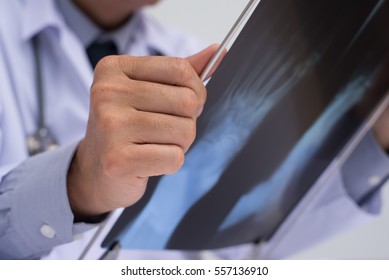 Close Up Of Male Doctor Looking At Fracture Foot Film X-ray On Metallic Hanger, Accidental Health Insurance Concept