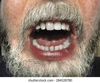 A close up of a male face with beard and open mouth baring teeth. - Powered by Shutterstock