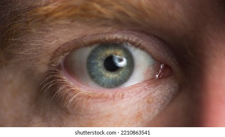 Close Up Of A Males Eye Wide Open.
