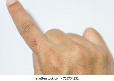 Close Man Have Finger Wound Isolated Stock Photo 728734231 Shutterstock   Close Man Have Finger Wound 260nw 728734231 