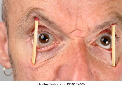 Close Up Of Man Keeping Eyes Wide Open With Match Sticks