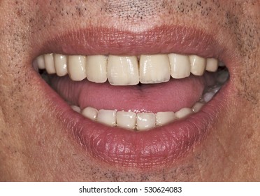 Close Up Of Man Mouth