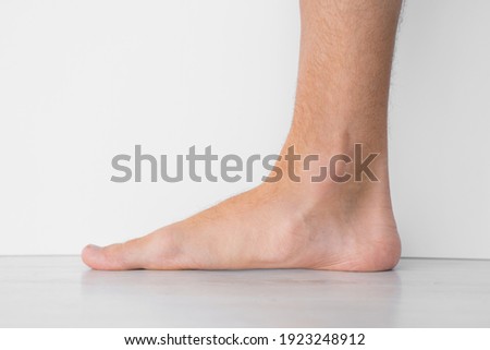 Close up of mans bare foot with strong flat feet also called pes planus or fallen arches.