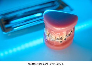 Close Up Of Model Of Jaw With Braces. Orthodontic Tools