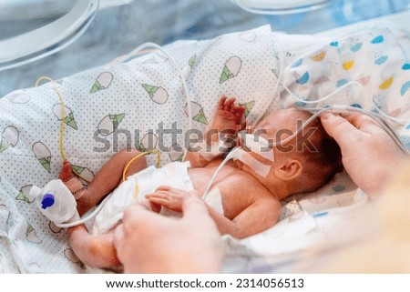 Close up of mother's hands holding new born baby born at 32 weeks gestation in intensive care unit in a medical incubator.