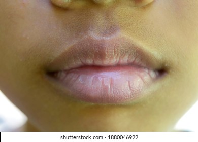 Close Up Of The Mouth Of A 10 Year Old Asian Girl