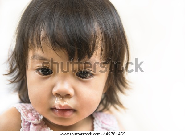 幼い女の子の鼻から流れる粘液の接写 子どもは鼻水が澄んでいて ウイルスもある の写真素材 今すぐ編集