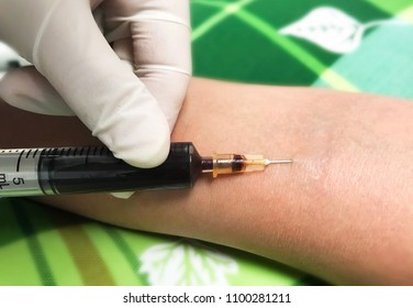 Close Up Nurse Pricking Needle Syringe In The Arm Patient Drawing Blood Sample For Blood Test.