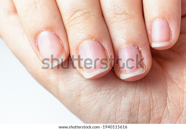 Close\
up on a female hands with dry skin and hangnails. Long fingernails\
and cuticles in bad condition. Chapped and neglected hands. Hands\
care concept. Lack of manicure in a lady\
fingers.