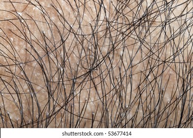human hair zoomed in