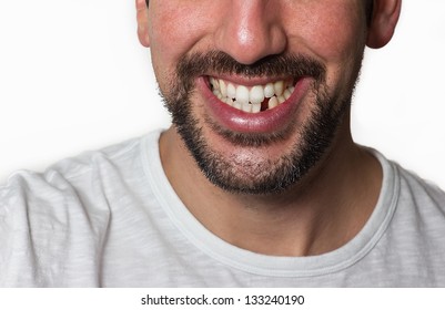 Close Up On A Man Smiling While He Is Missing A Tooth.