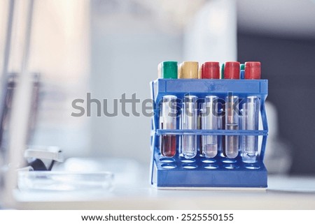 Close up on multiple samples with chemicals on plastic test tube rack resting on scientists workstation in laboratory, copy space