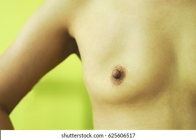 Close Up On Woman Breast, Show The Scar On Breast From Breast Operation Or Mastectomy (preserve Nipple)