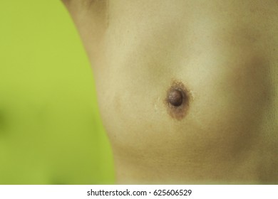 Close Up On Woman Breast, Show The Scar On Breast From Breast Operation Or Mastectomy (preserve Nipple)