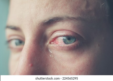 Close Up On A Woman's Bloodshot Crying Eyes