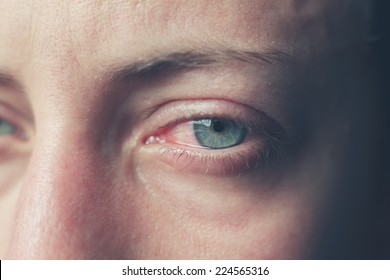 Close up on a woman's bloodshot crying eyes