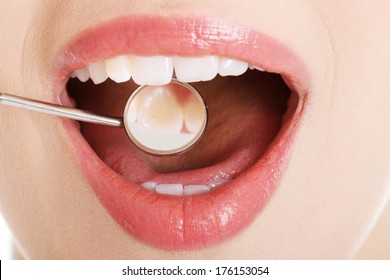 Close Up On Woman's Open Mouth With Dental Mirror.