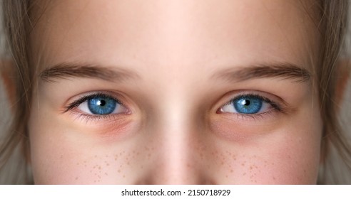 Close Up Part Female Face, Girl 15-18 Years Old, Human Eye Looking Straight Ahead, Concept Of Surveillance, Tracking, Vision Examination, Cosmetic Procedures, Teenage Problems, Freckles On The Skin