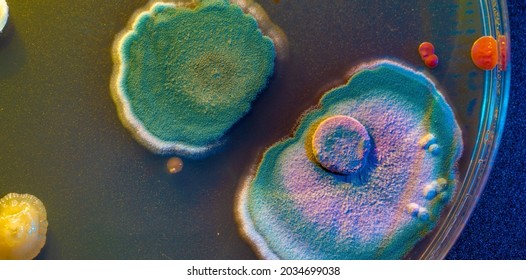 Close Up Petri Of Dish With Microbe Colony