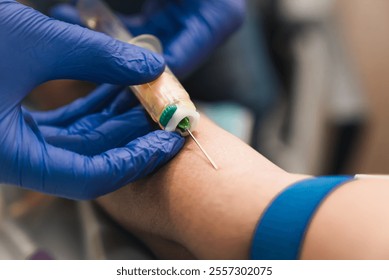 close up of phlebotomy process for blood testing