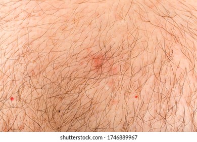 Close Up Photo Of Hairy Human Skin 