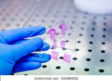 Close up photo of hand in blue glove handing histological liver tissue sample