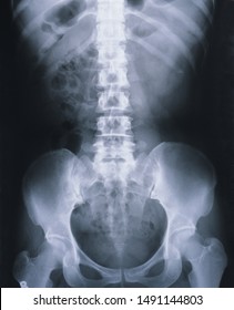 Close Up Photo Of Human Body Xray