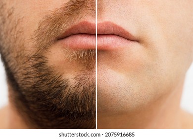 Close up photo of a man's face before and after shaving. a young man with a beard. Comparison of a man's face with a beard and without a beard. use of aftershave cream.