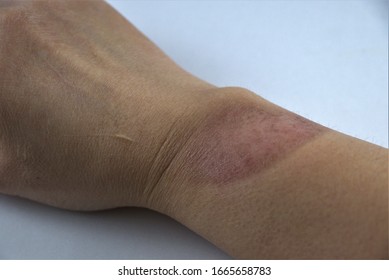 210 Dorsal wrist Images, Stock Photos & Vectors | Shutterstock