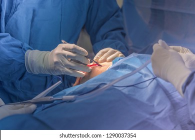 2,077 Scalpel Cutting Skin Images, Stock Photos & Vectors | Shutterstock