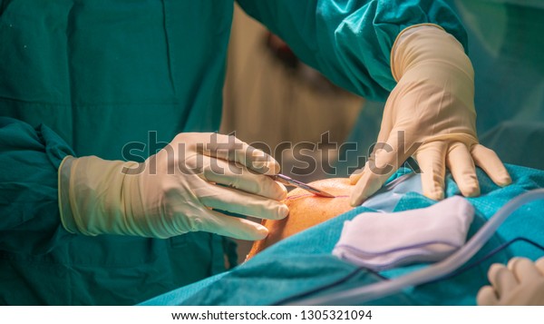 Close up photo of surgeon 's hand during hold the scalpel and made incision on the patient 's skin under the good light from surgical lamp. Picture in blue tone with copy space. Medical concept. 