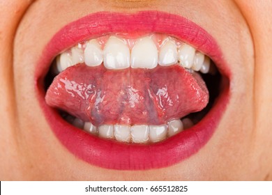 Close Up Picture Of A Young Female's Mouth With Perfect White Teeth And Twisted Tongue