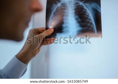 Close up picture of young man doctor who analysis chest x ray