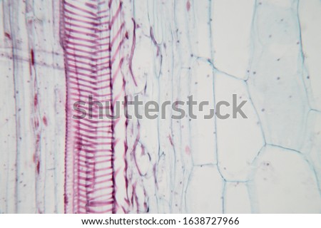  Close up Plant Stem under the microscope for classroom education.
