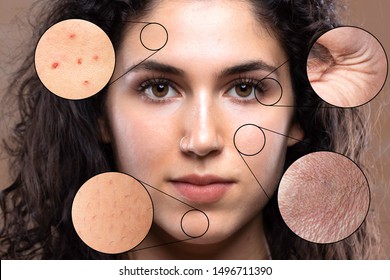 A close up portrait of a beautiful young caucasian girl. Magnified circles show problem areas of the skin causing stress and worry in millennials.