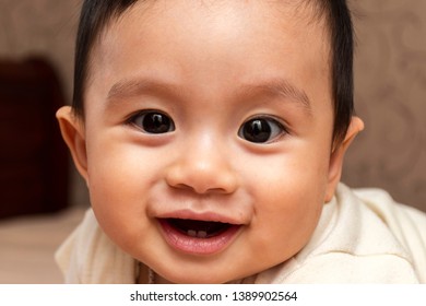 Close Up Portrait Of Cute Little Baby Boy With Atopic Dermatitis On His