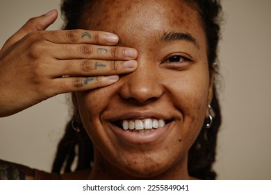 Close up portrait of ethnic young woman smiling candidly with one eye closed, skin texture acne scars