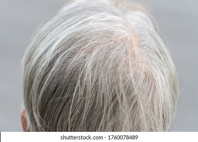 Close Up Of Portrait Gray Hair Of Old Asian Woman.